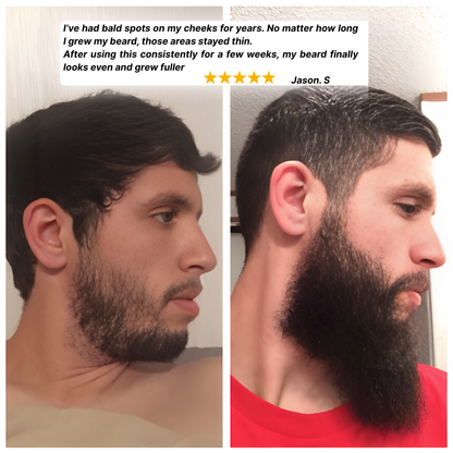 Regenx™ | Beard Growth Serum Roll-on