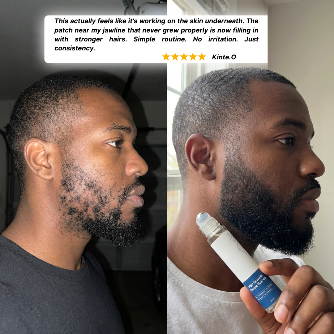 Regenx™ | Beard Growth Serum Roll-on