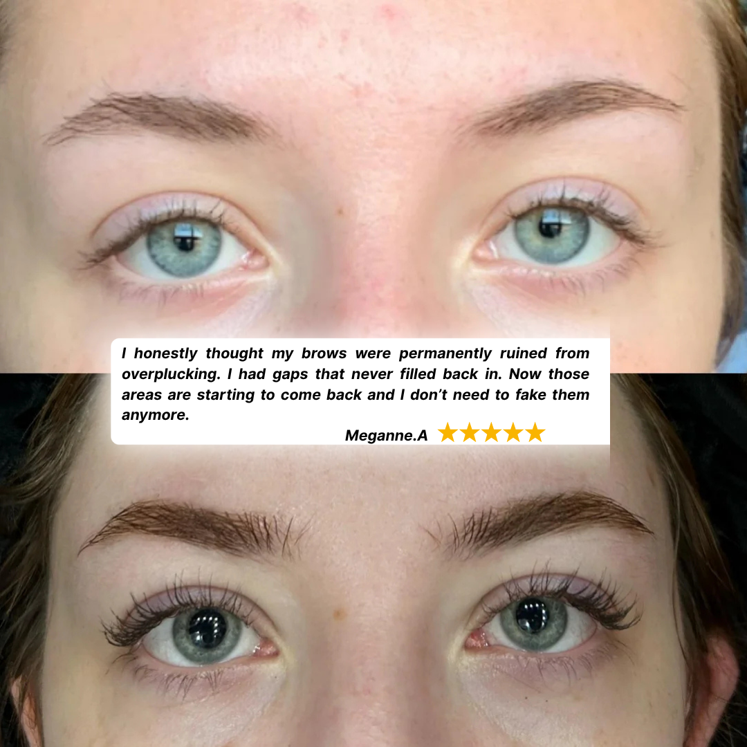 GrowEase™ Eyebrow Growth Serum