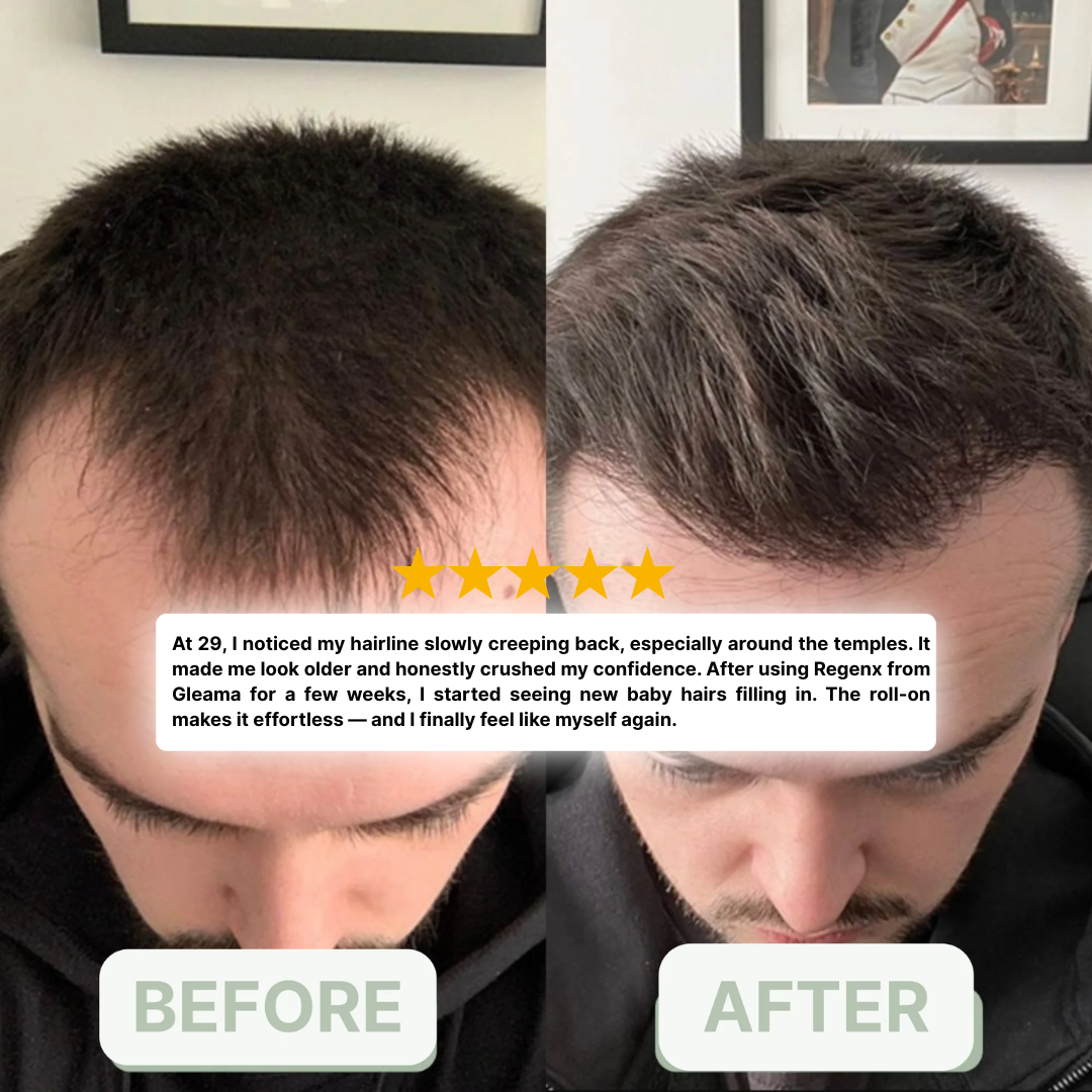 Regenx™ | Advanced Hair Growth Roll-on Serum