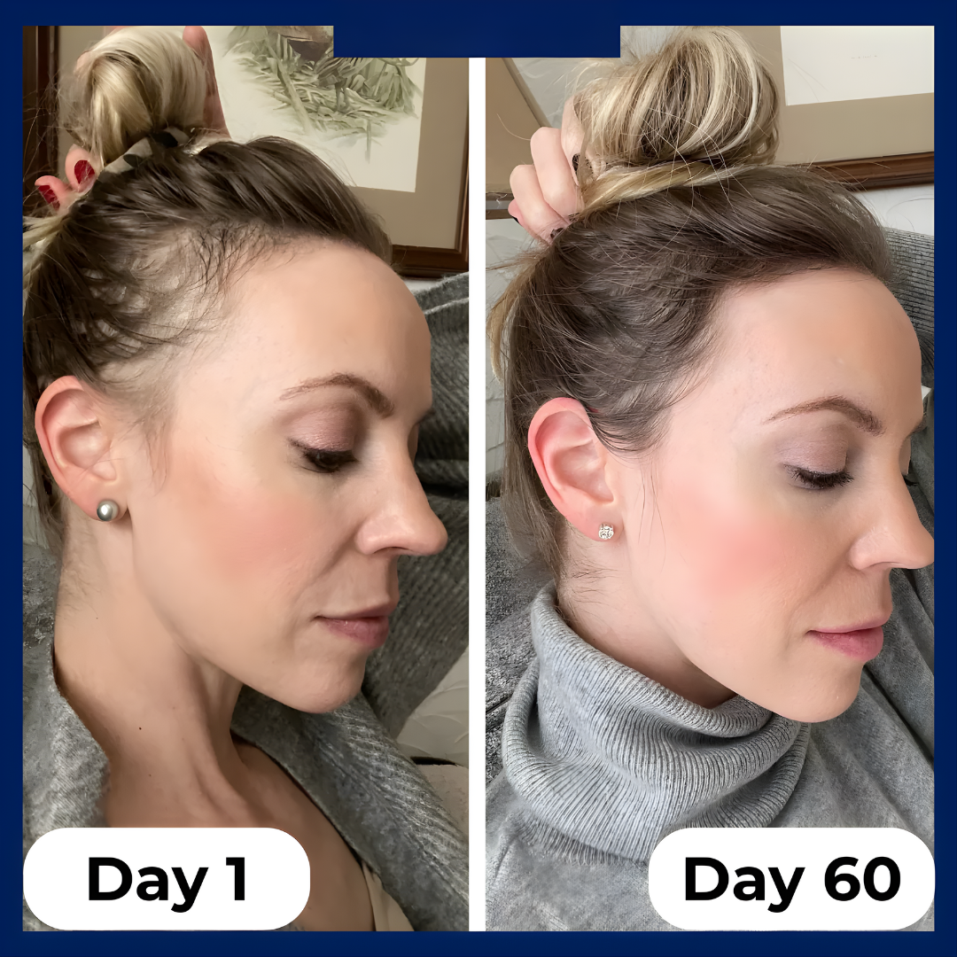 Regenx™ | Advanced Hair Growth Roll-on Serum