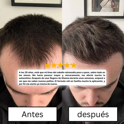 Regenx™ | Sérum Capilar en Roll-on