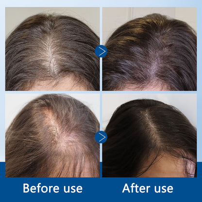 Regenx™ Hair Growth Serum Roll-on