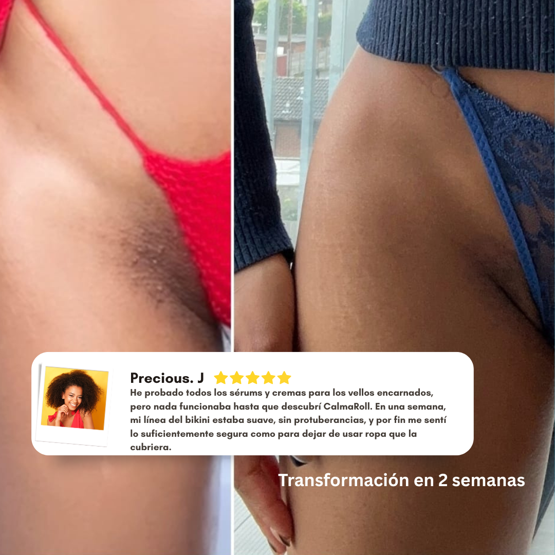 CalmaRoll | Roll Calmante